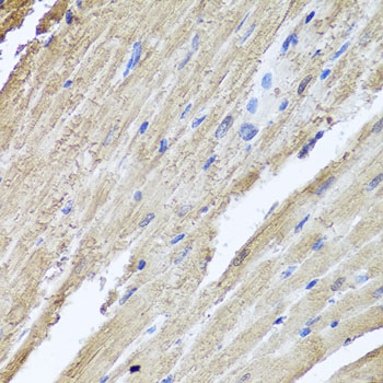 PIK3C2A Rabbit polyclonal antibody
