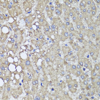 PIK3C2A Rabbit polyclonal antibody