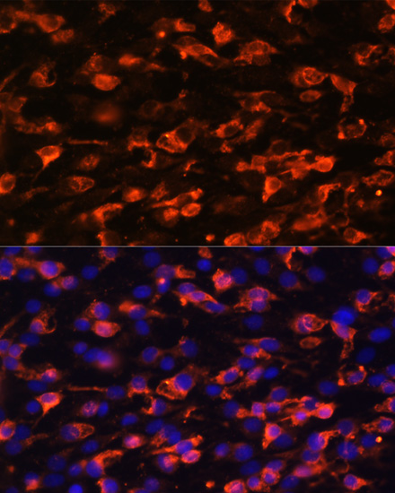 PIK3C2A Rabbit polyclonal antibody