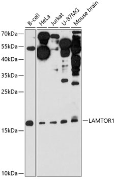 LAMTOR1 Rabbit polyclonal antibody