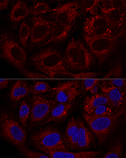 LAMTOR1 Rabbit polyclonal antibody