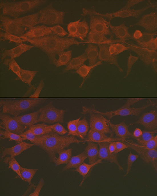 Caspase-3 Rabbit polyclonal antibody
