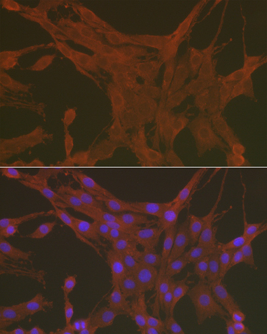 Caspase-3 Rabbit polyclonal antibody
