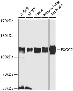 EXOC2 Rabbit polyclonal antibody