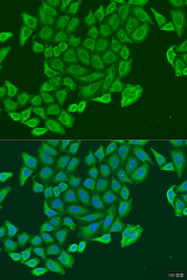 EXOC2 Rabbit polyclonal antibody