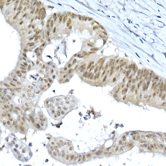 METTL3 Rabbit polyclonal antibody