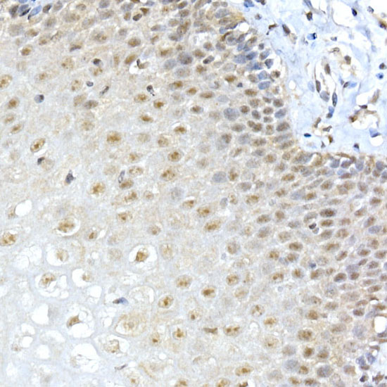 METTL3 Rabbit polyclonal antibody