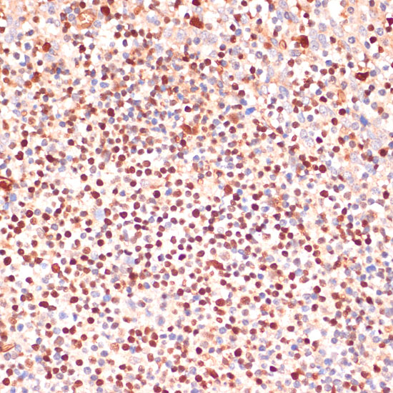 ALOX5 Rabbit polyclonal antibody