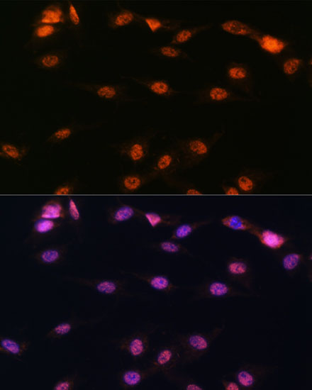 ALOX5 Rabbit polyclonal antibody