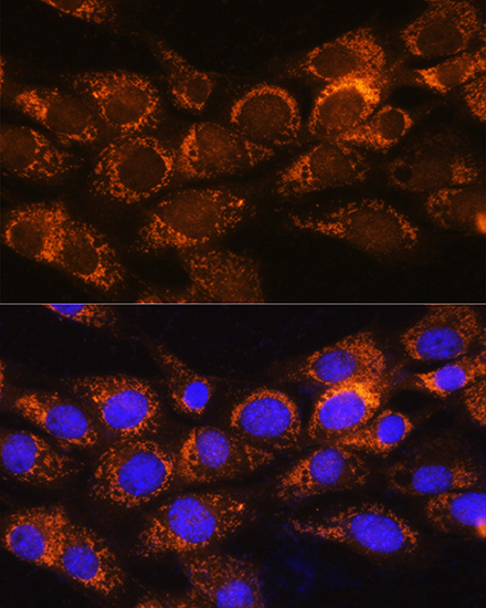 BCKDHA Rabbit polyclonal antibody