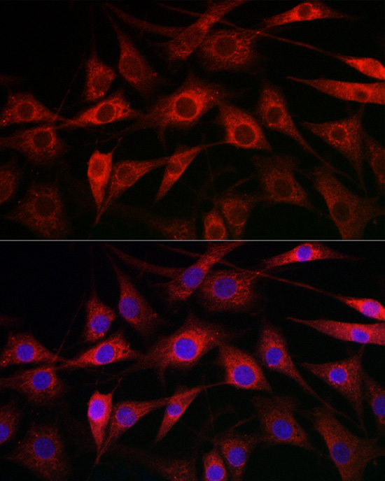 CYP1A1 Rabbit polyclonal antibody