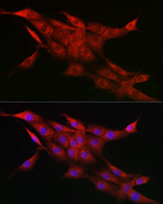 CYP1A1 Rabbit polyclonal antibody
