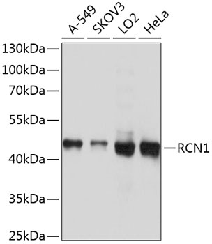 RCN1 Rabbit polyclonal antibody