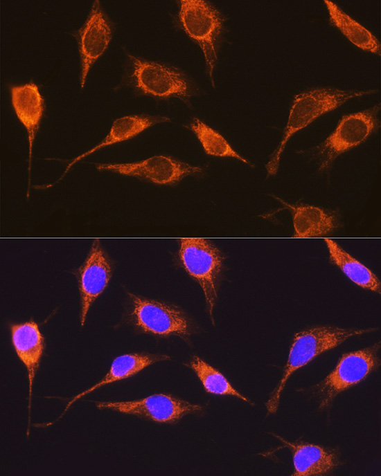 RCN1 Rabbit polyclonal antibody
