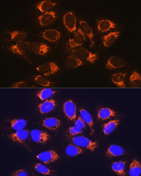 RCN1 Rabbit polyclonal antibody