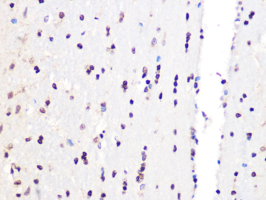 PCIF1 Rabbit polyclonal antibody