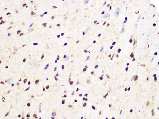 PCIF1 Rabbit polyclonal antibody