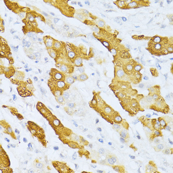 CYP2E1 Rabbit polyclonal antibody