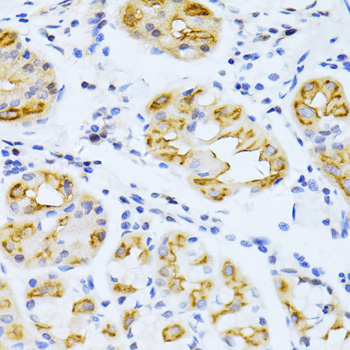 CYP2E1 Rabbit polyclonal antibody