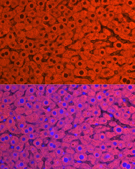 CYP2E1 Rabbit polyclonal antibody