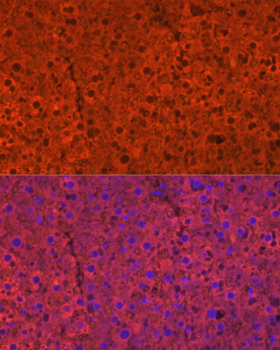 CYP2E1 Rabbit polyclonal antibody