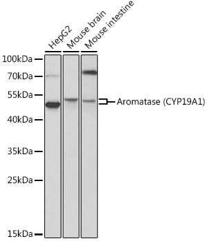 Aromatase (CYP19A1) Rabbit polyclonal antibody