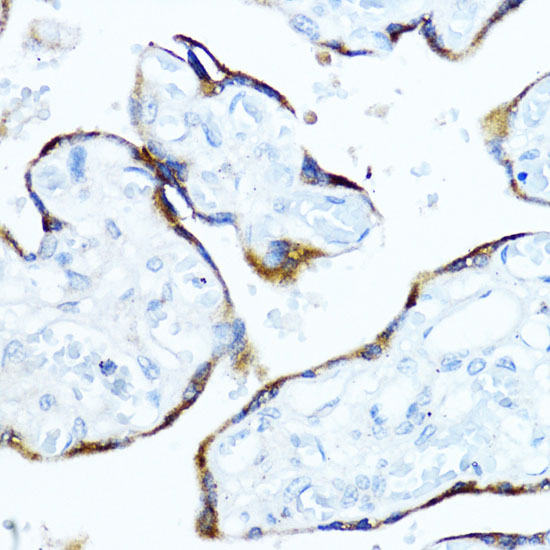 Aromatase (CYP19A1) Rabbit polyclonal antibody