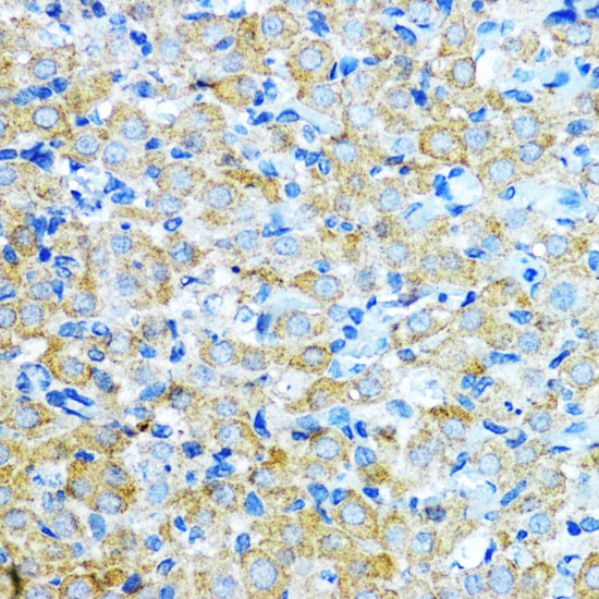 Aromatase (CYP19A1) Rabbit polyclonal antibody