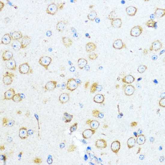 Aromatase (CYP19A1) Rabbit polyclonal antibody