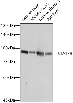 [KO Validated] STAT5B Rabbit polyclonal antibody