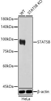 [KO Validated] STAT5B Rabbit polyclonal antibody