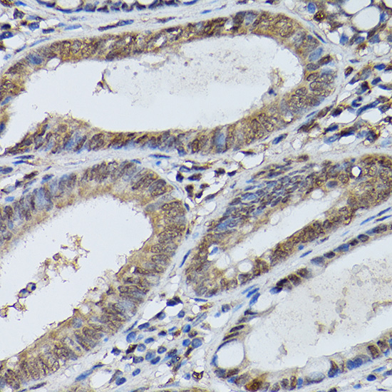 [KO Validated] STAT5B Rabbit polyclonal antibody