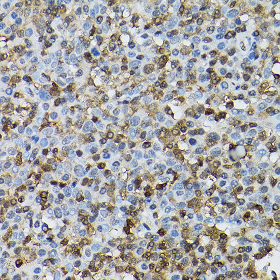[KO Validated] STAT5B Rabbit polyclonal antibody