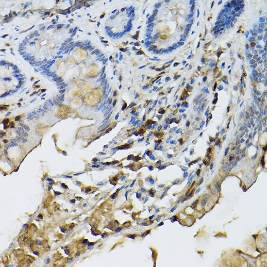 [KO Validated] STAT5B Rabbit polyclonal antibody