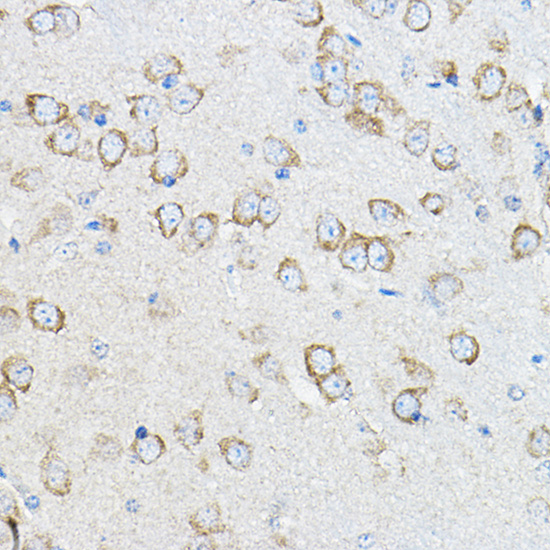 STIM1 Rabbit polyclonal antibody