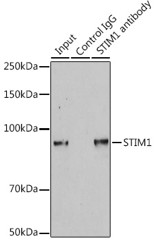 STIM1 Rabbit polyclonal antibody