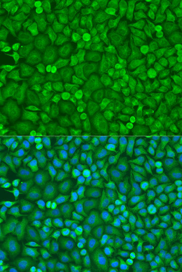[KD Validated] eIF4E Rabbit polyclonal antibody