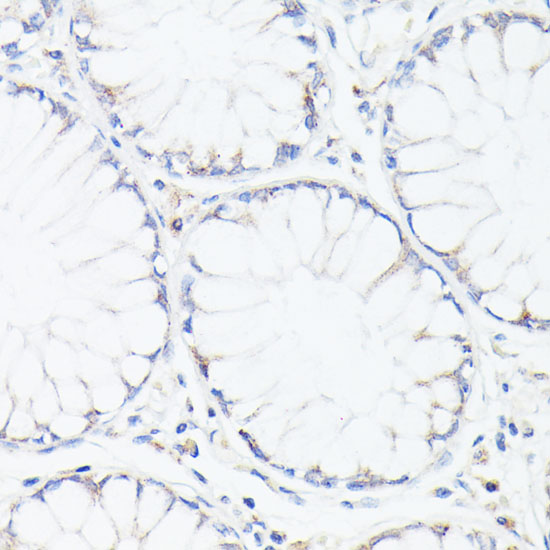 p53 Rabbit polyclonal antibody
