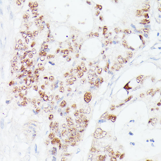 p53 Rabbit polyclonal antibody