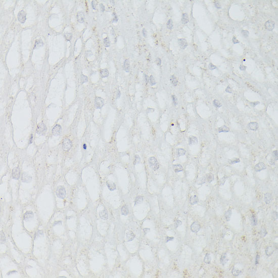 p53 Rabbit polyclonal antibody