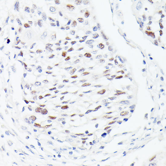 p53 Rabbit polyclonal antibody