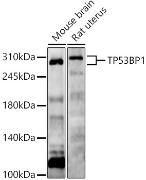 TP53BP1 Rabbit polyclonal antibody