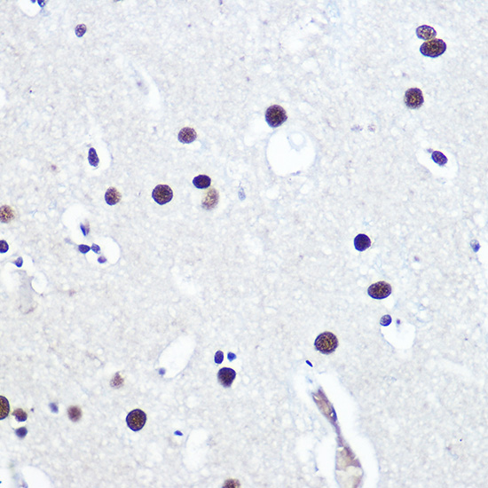 TP53BP1 Rabbit polyclonal antibody