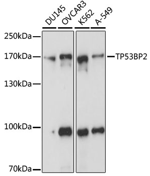 TP53BP2 Rabbit polyclonal antibody