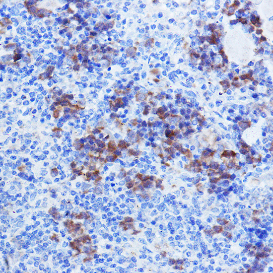 [KO Validated] TYSY Rabbit polyclonal antibody
