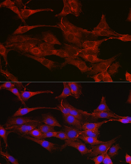 [KO Validated] TYSY Rabbit polyclonal antibody