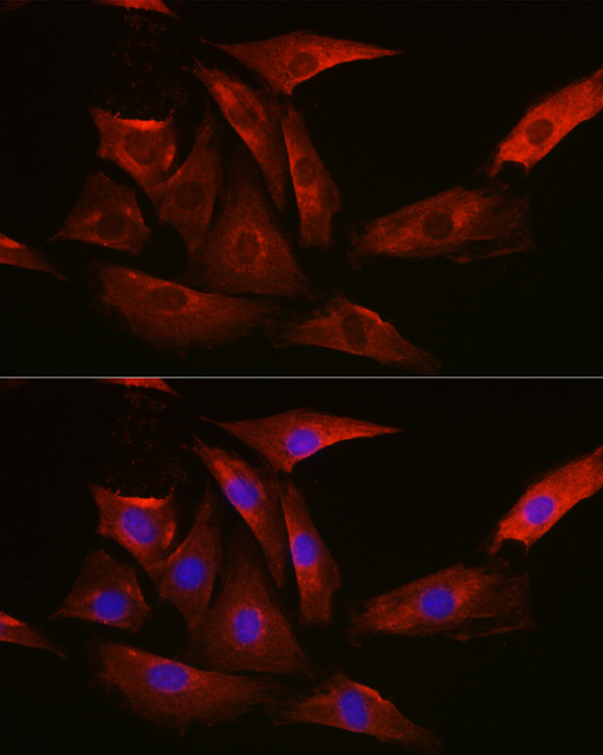 [KO Validated] TYSY Rabbit polyclonal antibody