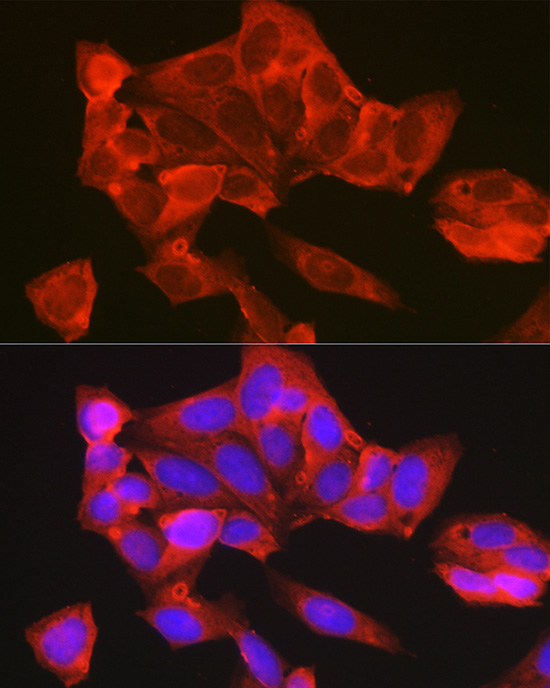 [KO Validated] TYSY Rabbit polyclonal antibody