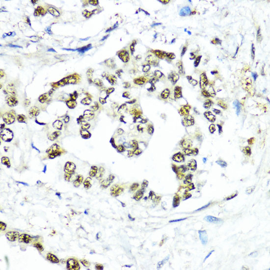 [KO Validated] SUMO1 Rabbit polyclonal antibody
