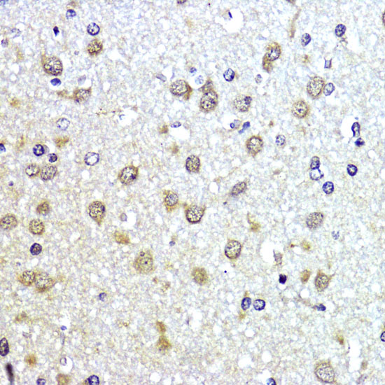 [KO Validated] SUMO1 Rabbit polyclonal antibody